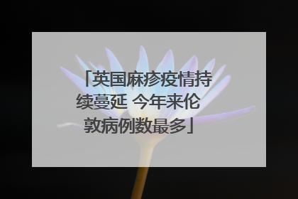 英国麻疹疫情持续蔓延 今年来伦敦病例数最多